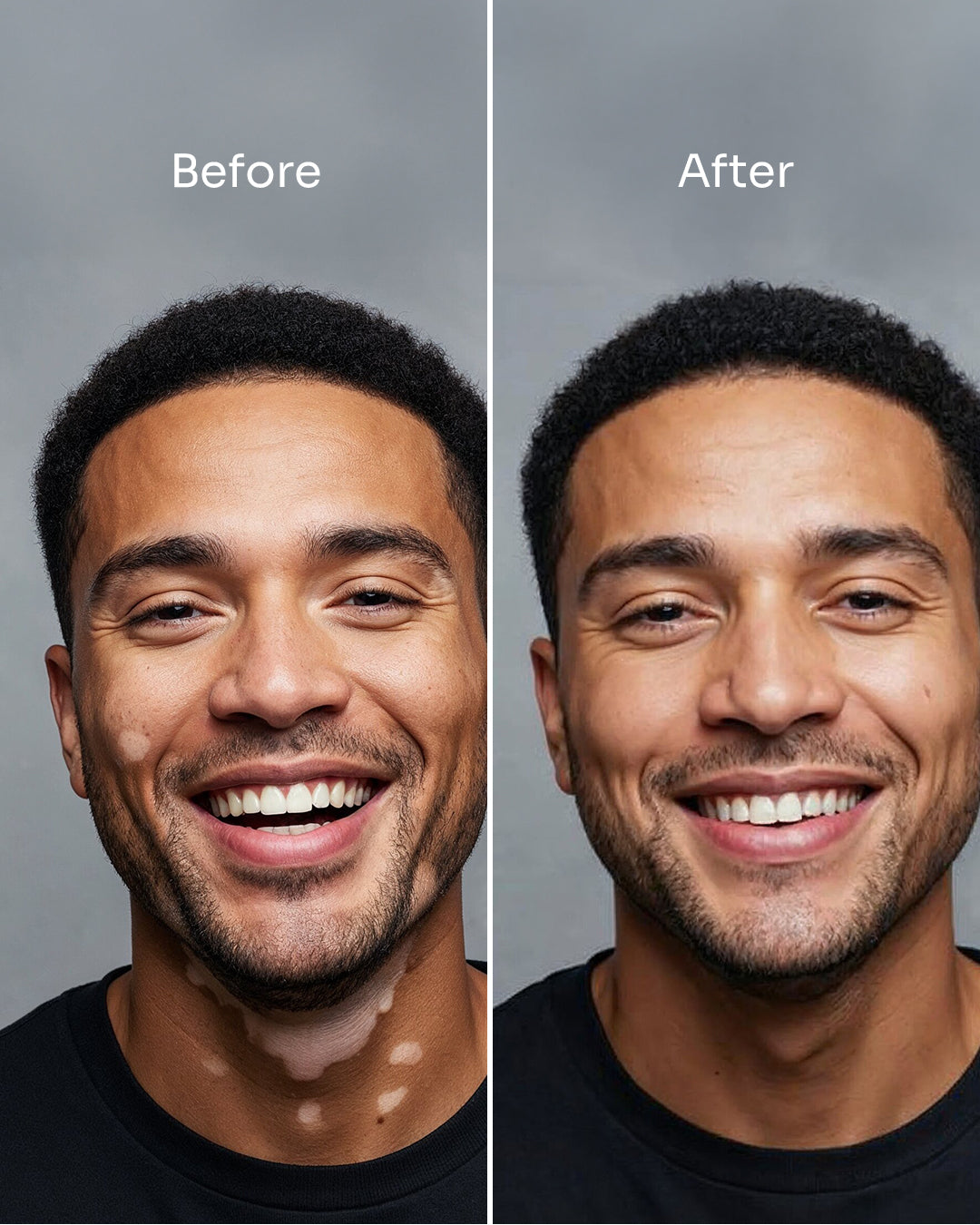 Skin_16_-_before_after