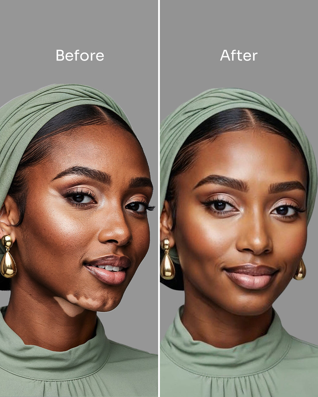 Skin_17_-_before_after