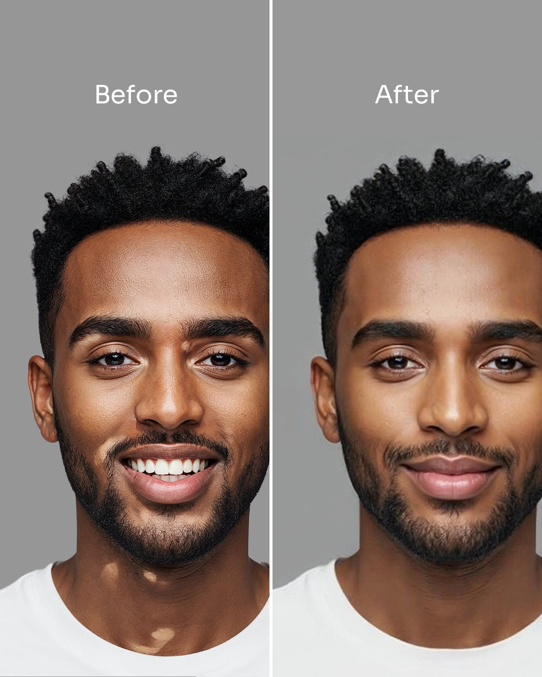 Skin_18_-_before_after