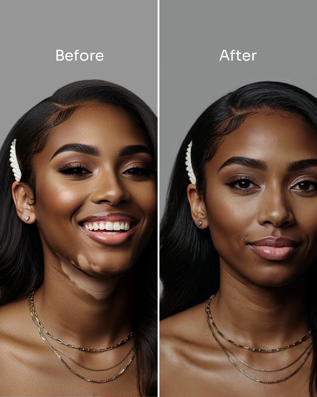 Skin_19_-_before_after