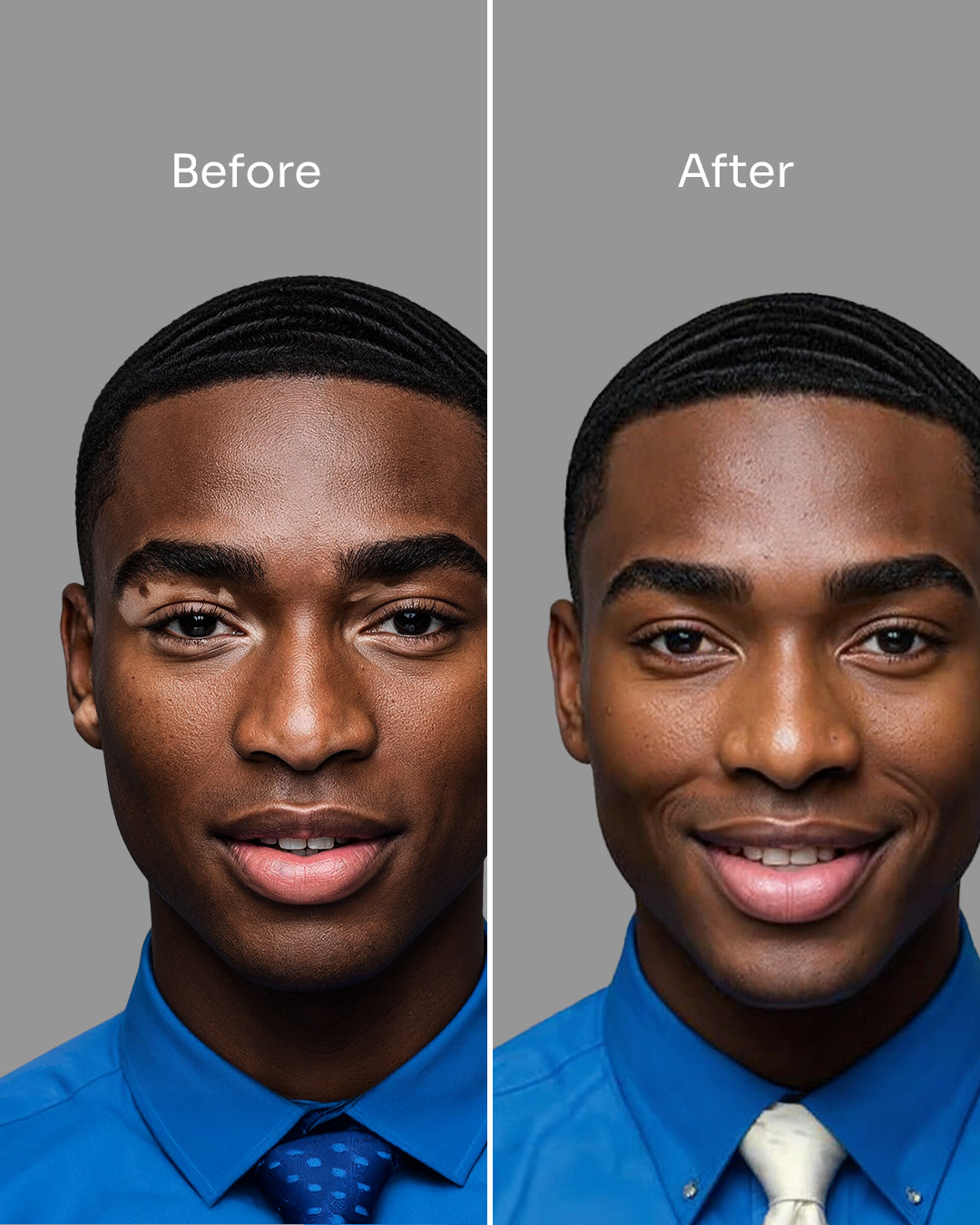Skin_20_-_before_after