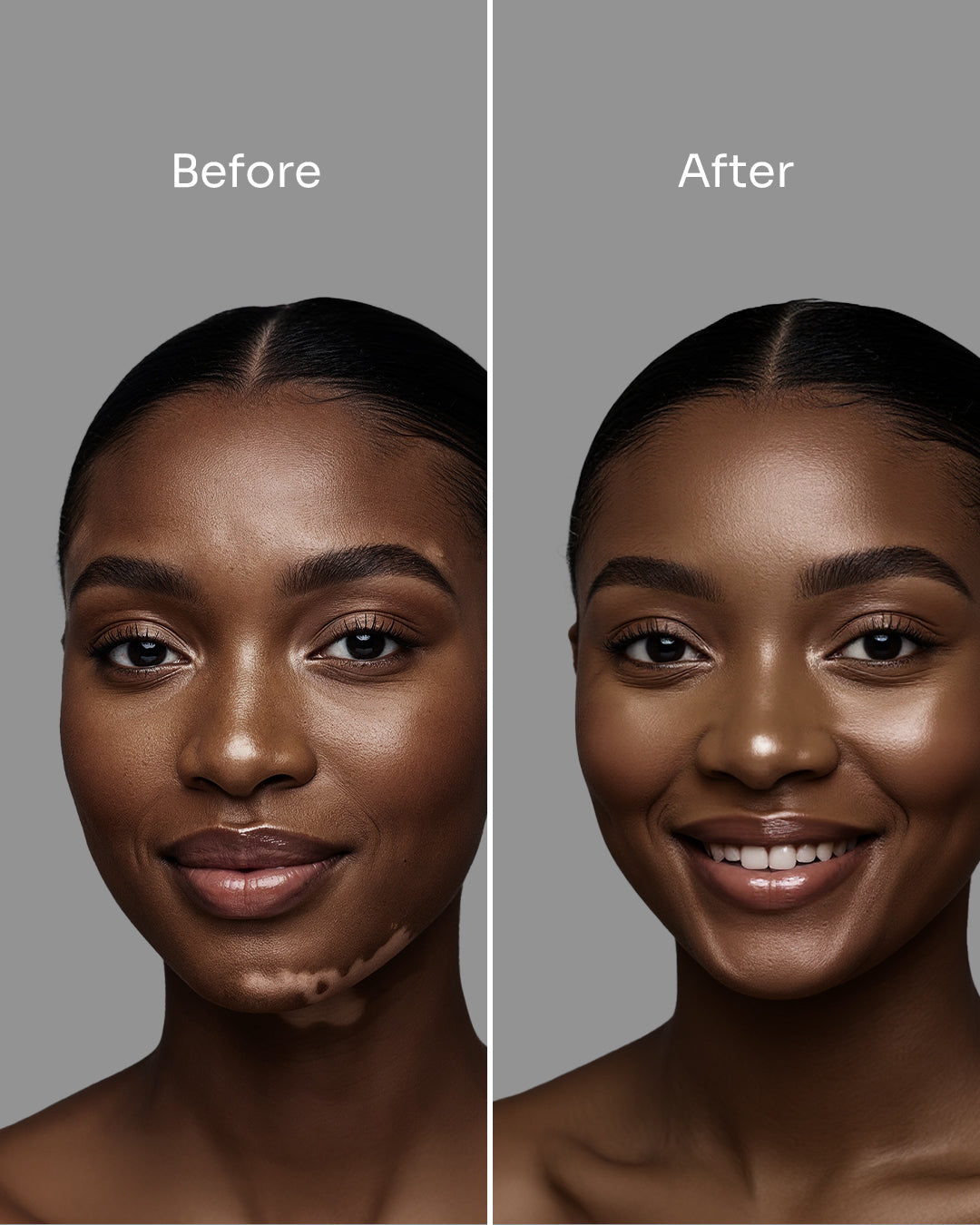 Skin_21_-_before_after